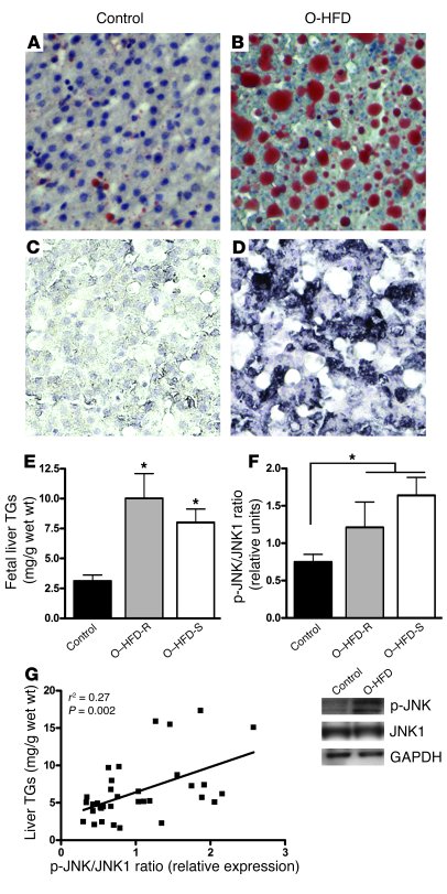 Maternal HFD feeding leads to lipid accumulation and activation of oxida...