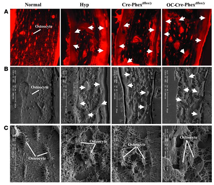 Bone histomorphology in normal, hyp-, Cre-PhexΔflox/y, and OC-Cre-PhexΔf...