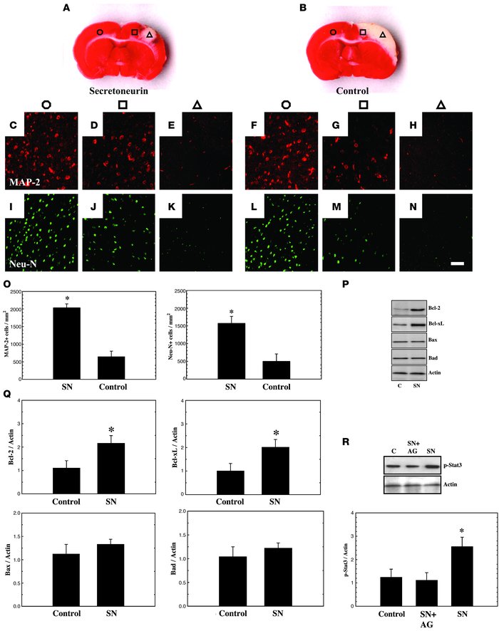 SN administration i.v. 30 minutes after cerebral ischemia rescued neuron...