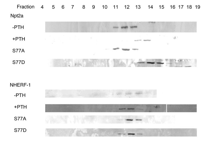 Representative sucrose density gradient ultracentrifugation experiment o...