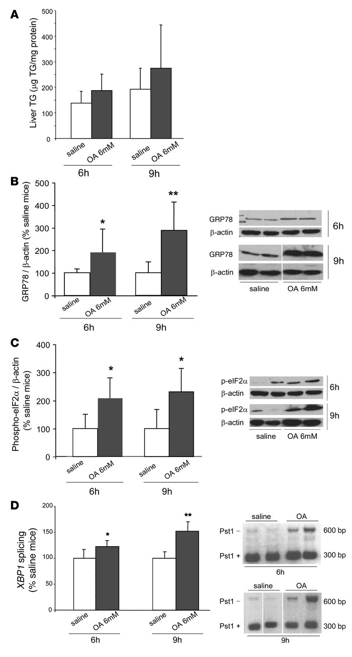 Intravenous infusions of 6 mM OA increase markers of hepatic ER stress i...