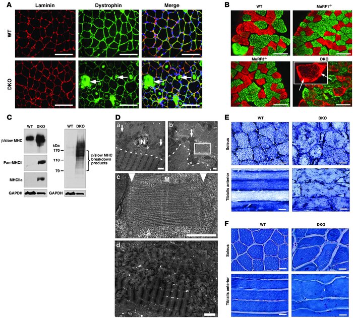 DKO mice display MSM.
(A) Immunohistochemistry of soleus muscle using an...