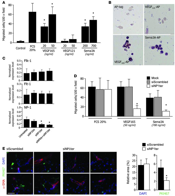 Fundamental role of NP-1 in CD11b+ cell recruitment by VEGF165 and Sema3...