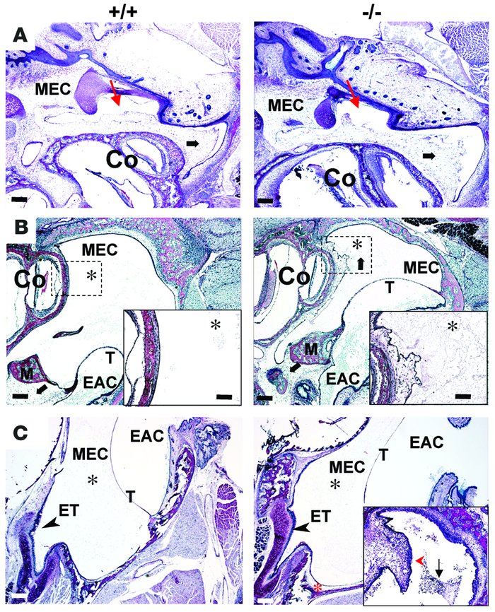 Comparison of postnatal middle ear cavitation in wild-type (+/+) and Eya...