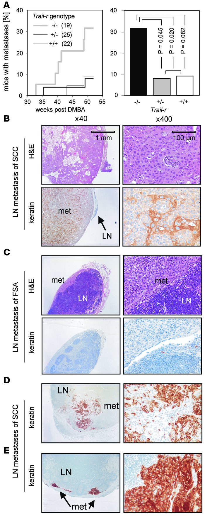 TRAIL-R suppresses lymph node metastases of skin carcinomas.
(A) Time co...