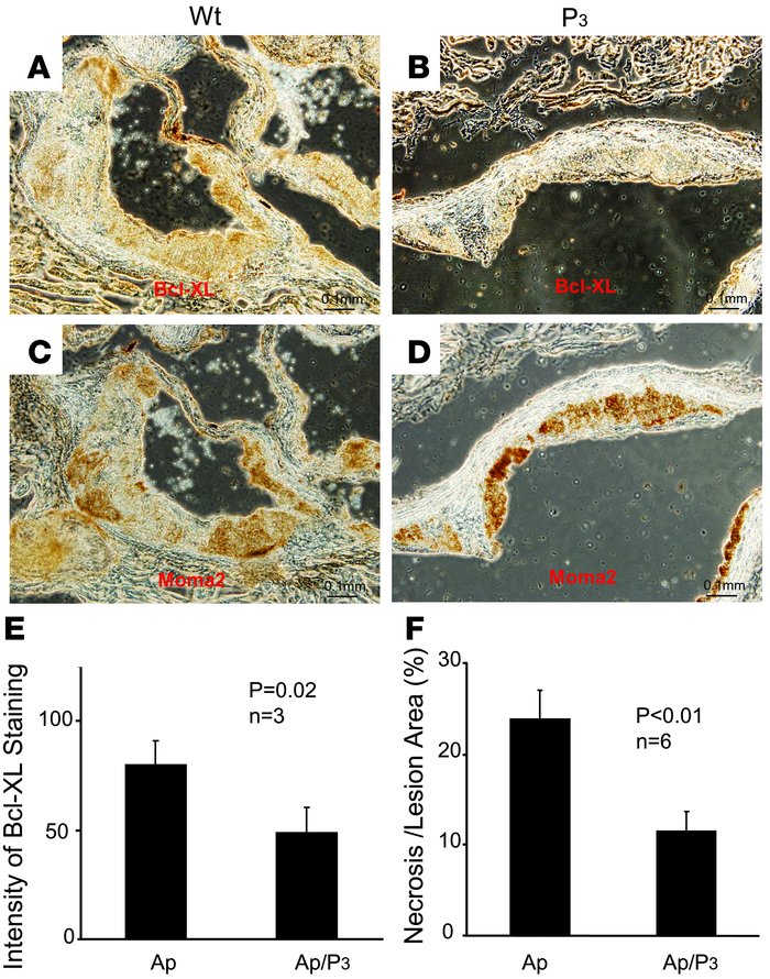 Effect of PLC β3 deficiency on BcL-XL expression in the lesions and on n...