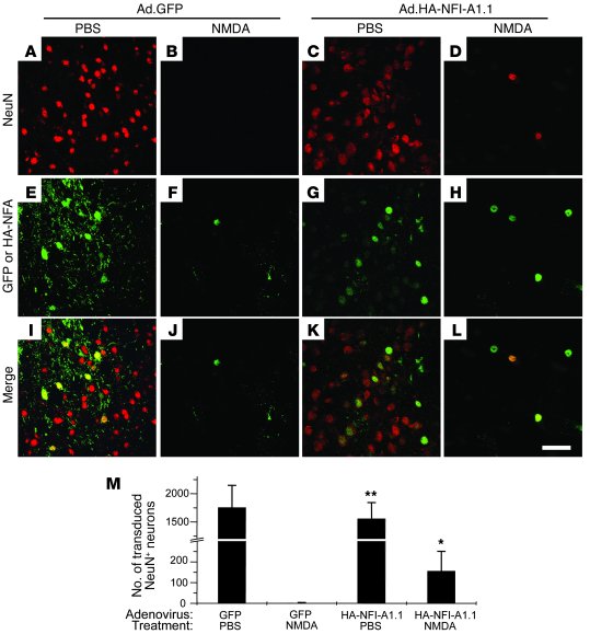 Delivery of NFI-A adenovirus into striatum followed by NMDA microinjecti...