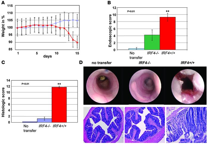 The protective effects of IRF4 deficiency are mediated via T lymphocytes...