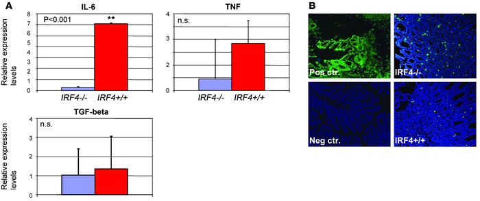 Analysis of cytokine expression and apoptosis in the colon of reconstitu...