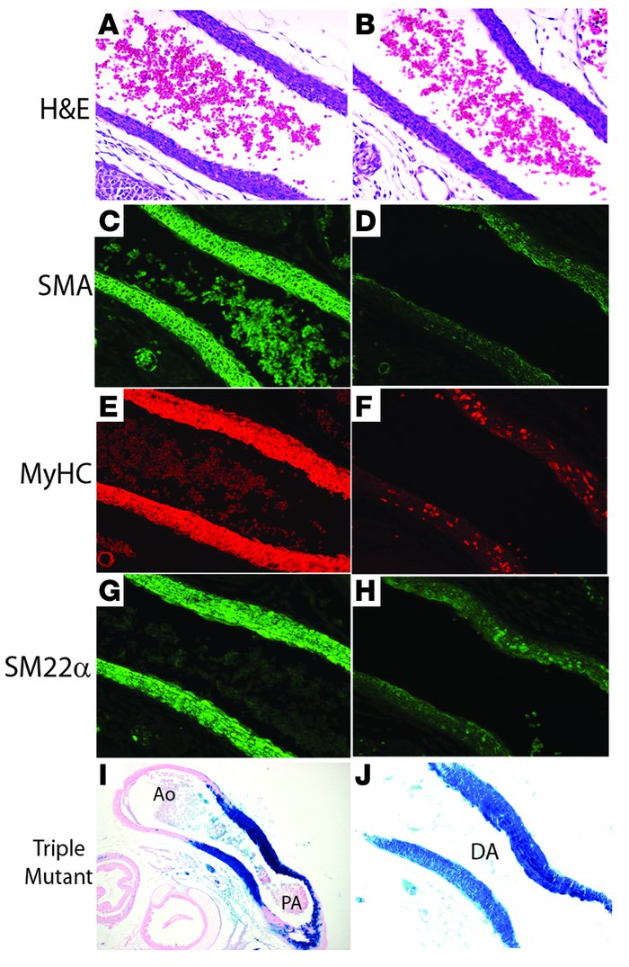 SMCs populating the DA of Myocd conditional mutant mice exhibit markedly...