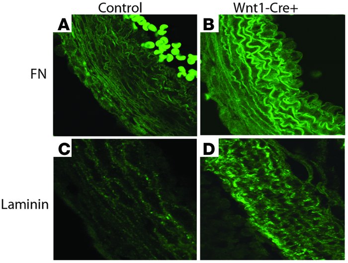 Accumulation of ECM protein in the DA of P2 MyocdF/F/Wnt1-Cre+ mutant mi...