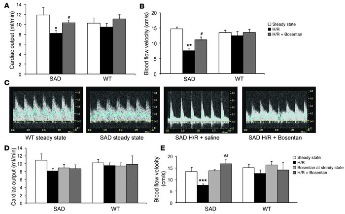 ETRA reverses and prevents the fall in renal blood flow velocity (RBF) i...