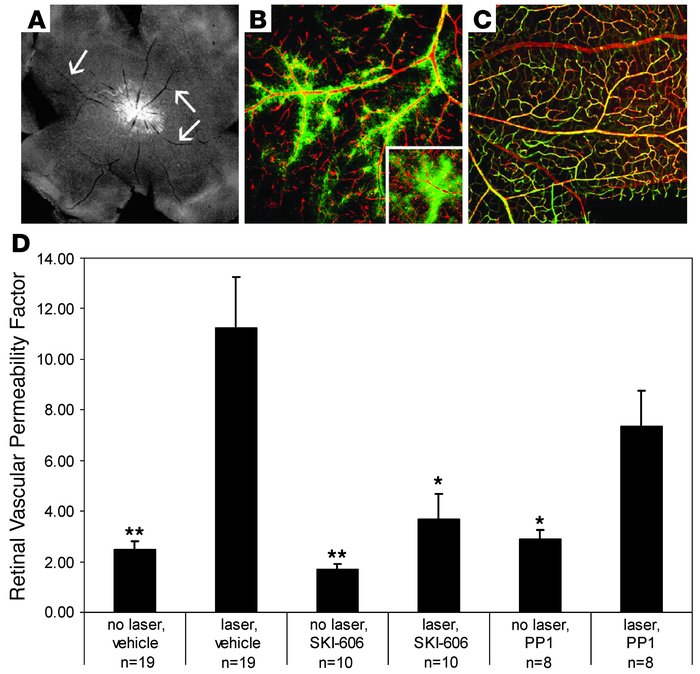 Src kinase antagonists reduce laser-induced retinal vascular permeabilit...