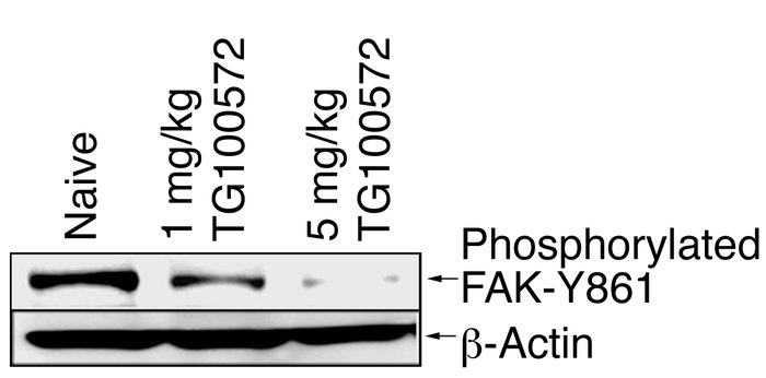 TG100572 inhibits FAK-Y861 phosphorylation during developmental angiogen...