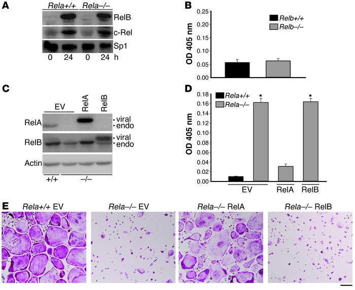 Enhanced RANKL-induced apoptosis is specific for RelA.
   
(A) BMMs from...