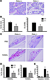 RelA is important for basal and stimulated OC formation in vivo.