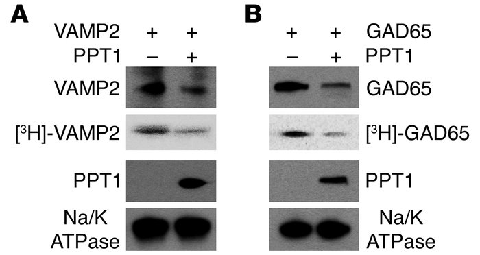 Correction of persistent membrane association of SV proteins in PPT1-def...