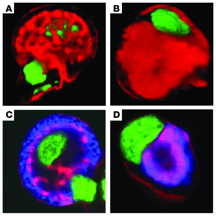 Abnormal canalicular structure in parietal cells from Hip1r-deficient mi...