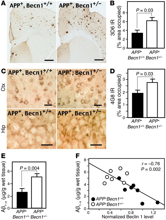 
APP+Becn1+/– mice have increased amyloid pathology.
   
(A and B) Aβ im...