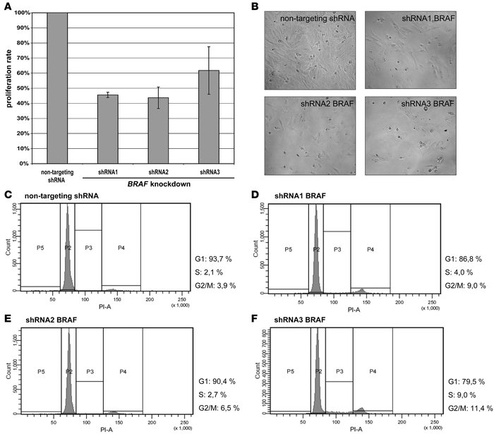 Stable silencing of BRAF expression in pilocytic astrocytoma cells.
   
...