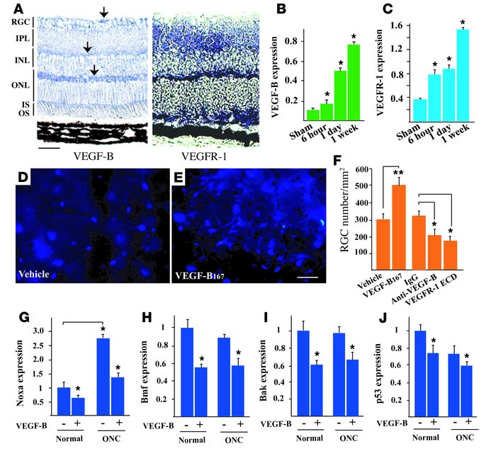 VEGF-B inhibits axotomy-induced apoptosis in the retina.
(A) VEGF-B is h...