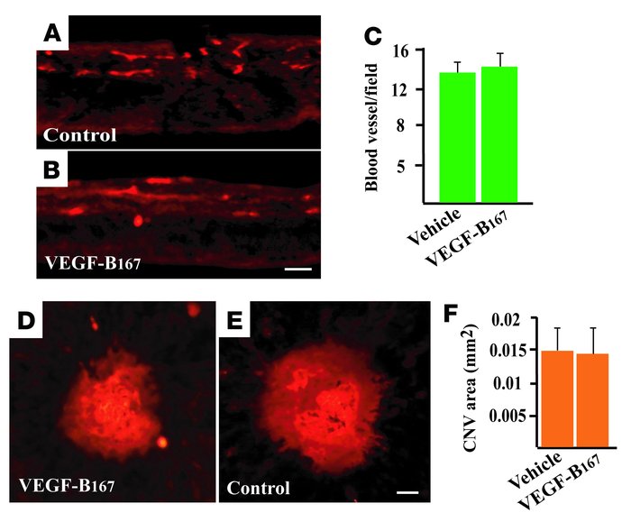 VEGF-B does not affect retinal angiogenesis after intravitreous injectio...