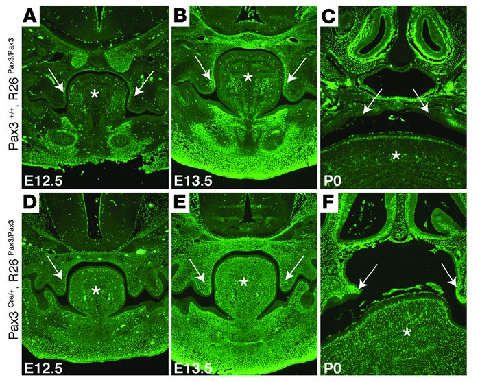 Endogenous and persistent Pax3 is expressed in the palate.
Frontal secti...