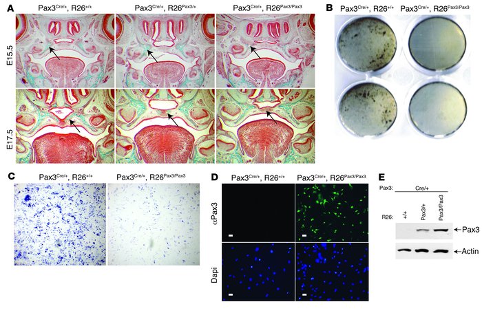 Persistent Pax3 expression impairs palate osteogenesis.
(A) Frontal sect...