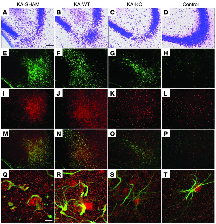Histological assessment of the antiepileptogenic effect of Adk–/– ES cel...