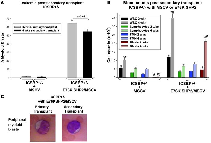 AML from mice transplanted with E76K SHP2–expressing ICSBP+/– bone marro...