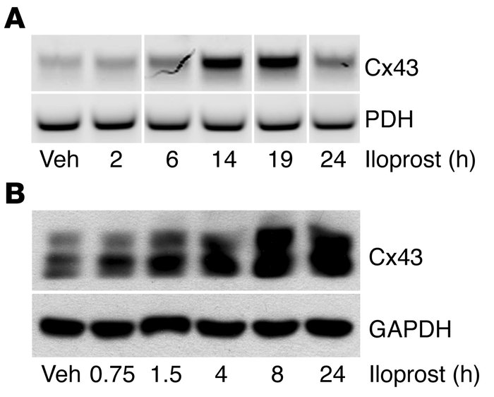 Iloprost induces expression of connexin 43 in human uSMCs.
(A) Human uSM...