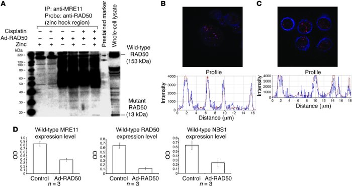 Mutant RAD50 protein interacts with endogenous RAD50 and downregulates t...