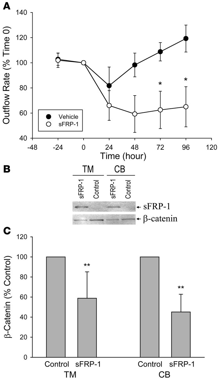 Effects of sFRP-1 on perfusion-cultured human eyes.
(A) Effect of recomb...