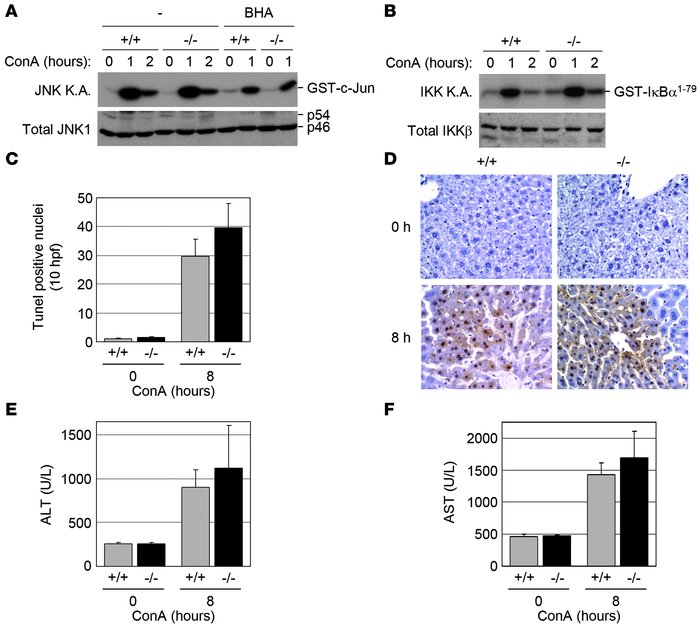 Normal susceptibility of Gadd45b–/– mice to ConA-induced hepatotoxicity....