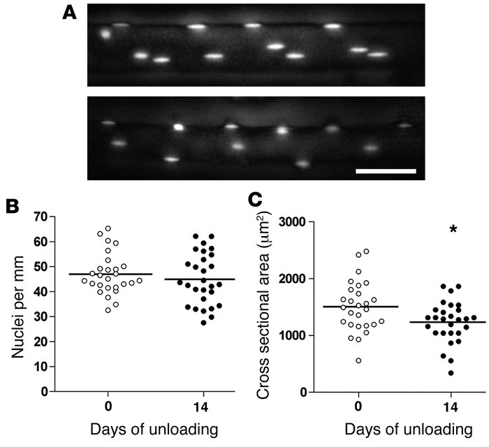 The effect of unloading on nuclei number and atrophy of single muscle fi...