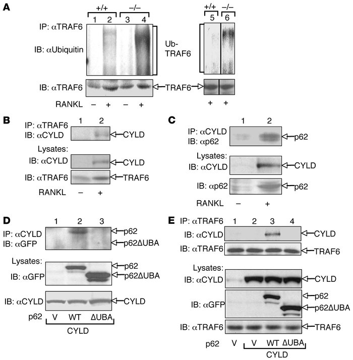 CYLD targets TRAF6, which is promoted by p62.
(A) Wild-type and Cyld–/– ...