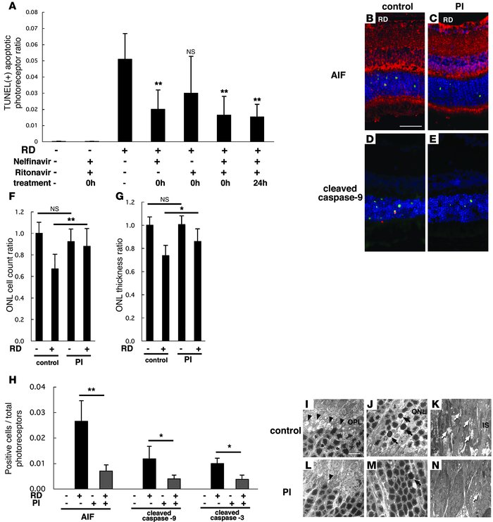 Systemic oral administration of HIV PIs prevents detachment-induced phot...