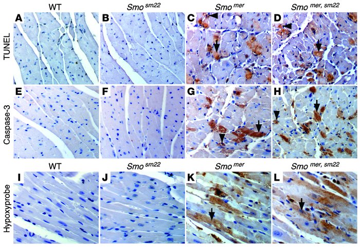 Loss of cardiac HH signaling results in cell death and tissue hypoxia.
(...
