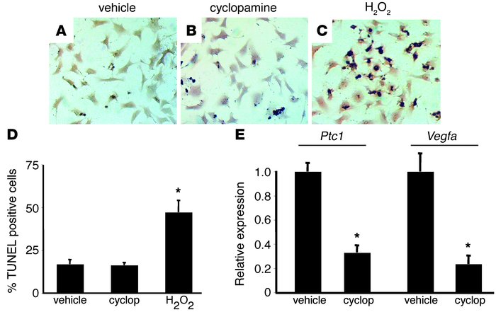 HH signaling is not required for survival of mouse neonatal cardiomyocyt...