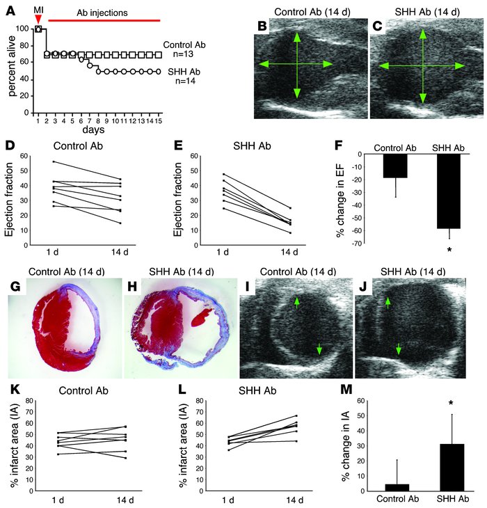 Endogenous HH signaling is critical for recovery following cardiac ische...