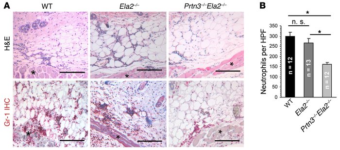 Impaired inflammatory response to locally formed ICs in Prtn3–/–Ela2–/– ...