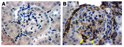 Enhanced podocyte injury in kidneys from lpr-KO mice.
   
Immunostaining...
