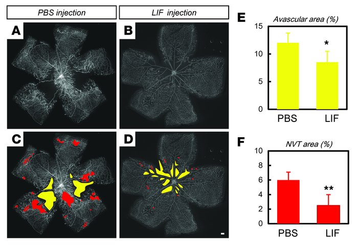 Exogenous LIF ameliorates pathological angiogenesis.
(A–D) IHC of PECAM-...