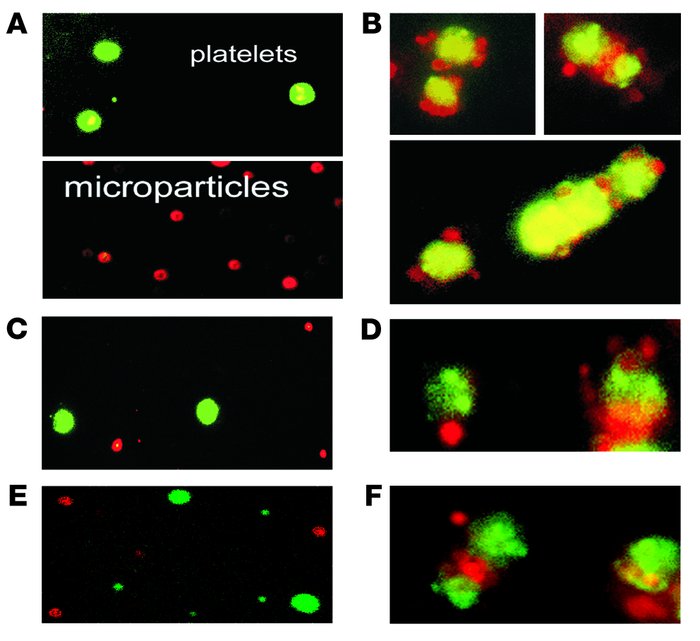 CD36-dependent binding of EMPs to platelets detected by immuno­fluoresce...