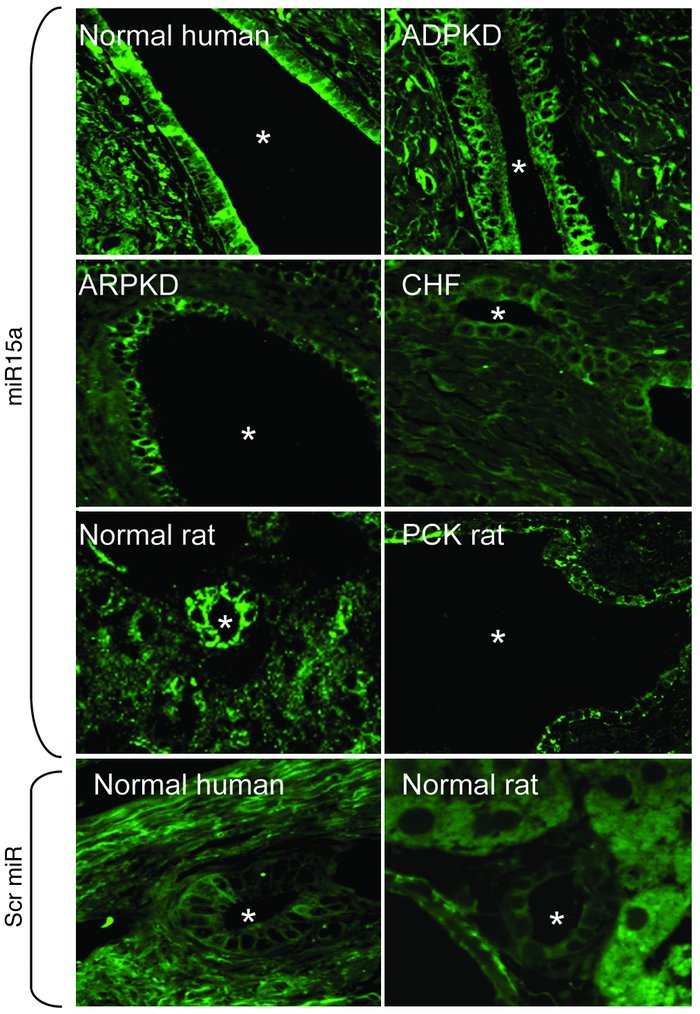 Expression of miR15a in human and rat liver tissue by locked nucleic aci...