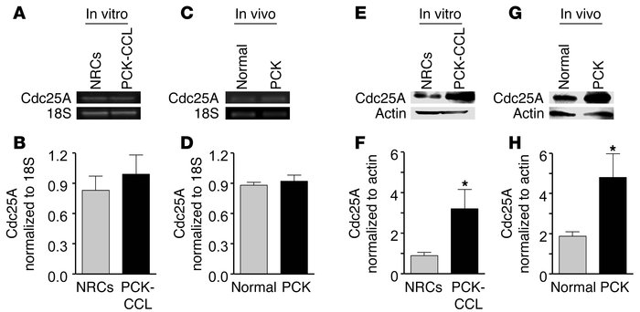 Expression levels of Cdc25A message and protein in vitro (NRCs and PCK-C...