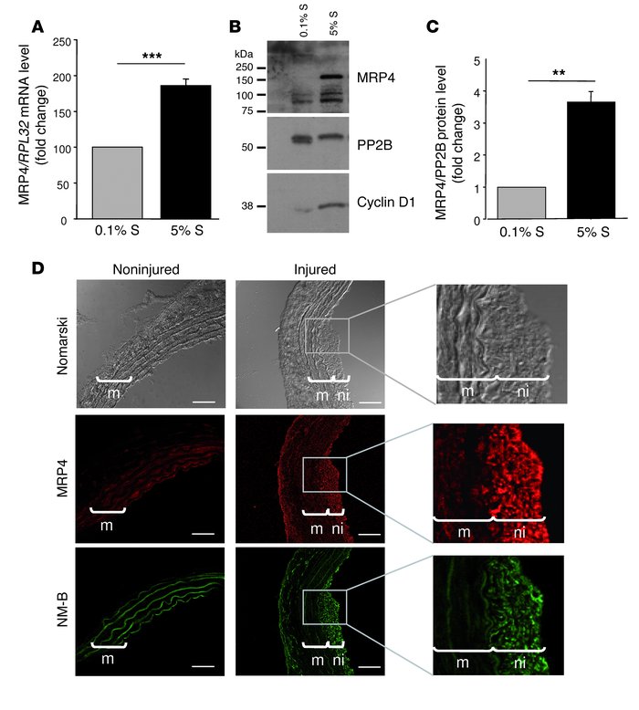 Upregulation of MRP4 in vitro and in vivo in proliferating SMCs.
(A) MRP...