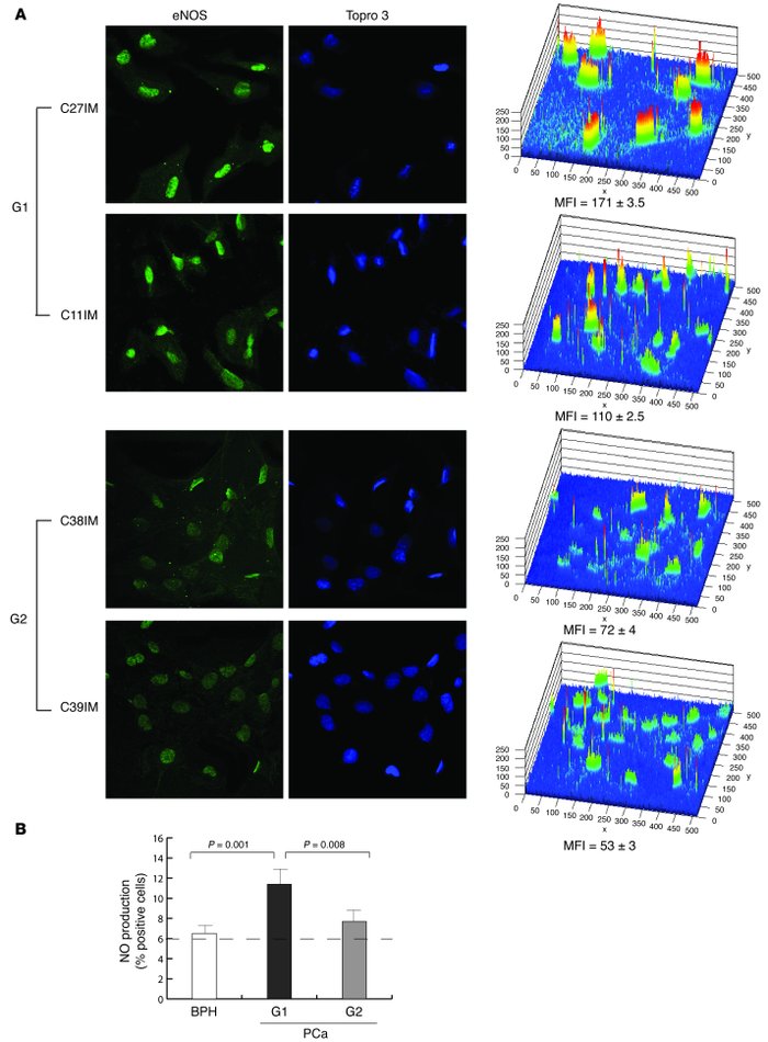 Expression and activity of eNOS in PCa-derived cells.
(A) G1 (C11IM and ...