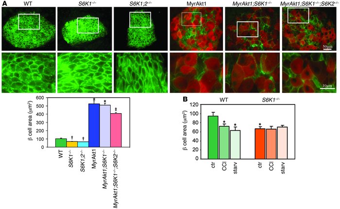 β cell growth control by MyrAkt1, nutrients, and the mTOR/S6K1 pathway.
...