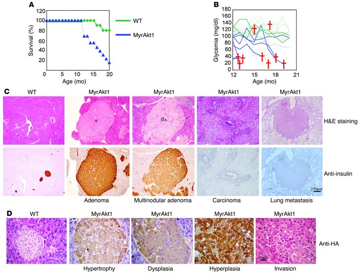RIP-MyrAkt1 mice develop insulinomas.
(A) Survival rate is decreased in ...